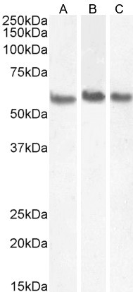 Coronin 1A Antibody in Western Blot (WB)