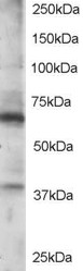 RGS14 Antibody in Western Blot (WB)