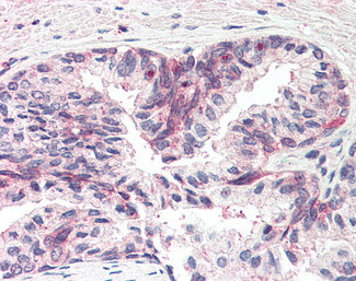 MSX1 Antibody in Immunohistochemistry (Paraffin) (IHC (P))