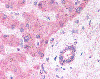 LRP6 Antibody in Immunohistochemistry (Paraffin) (IHC (P))