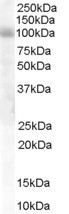 HPS6 Antibody in Western Blot (WB)