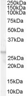 GPR40 Antibody in Western Blot (WB)