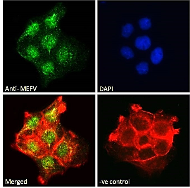 MEFV Antibody in Immunocytochemistry (ICC/IF)