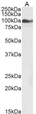 TRPC6 Antibody in Western Blot (WB)