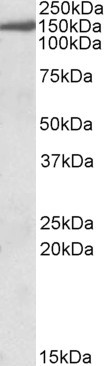 EPB41L3 Antibody in Western Blot (WB)