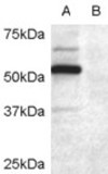 DCDC2 Antibody in Western Blot (WB)