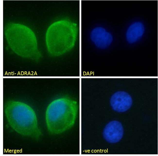 alpha-2a Adrenergic Receptor Antibody in Immunocytochemistry (ICC/IF)