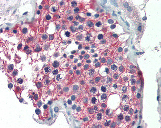 ALDH1A1 Antibody in Immunohistochemistry (Paraffin) (IHC (P))