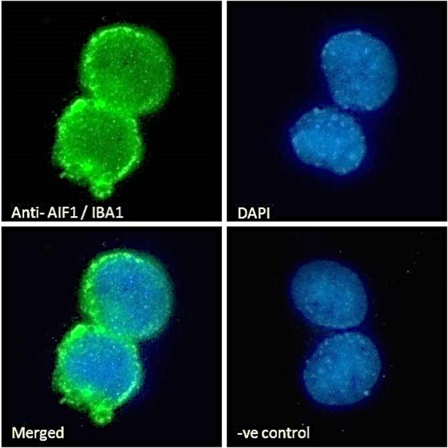 IBA1 Antibody in Immunocytochemistry (ICC/IF)