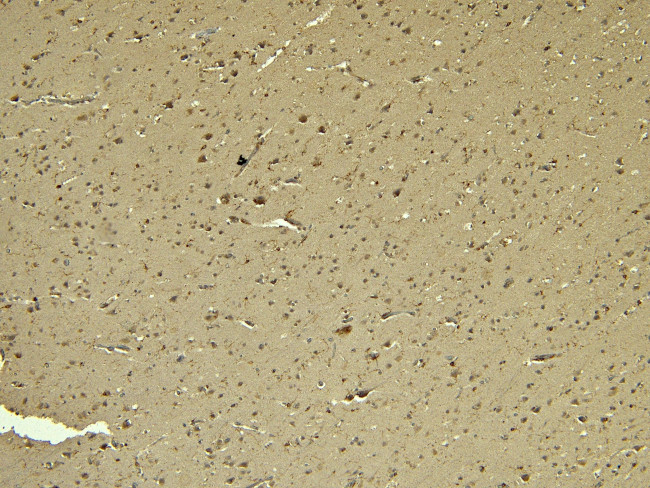 IBA1 Antibody in Immunohistochemistry (Paraffin) (IHC (P))