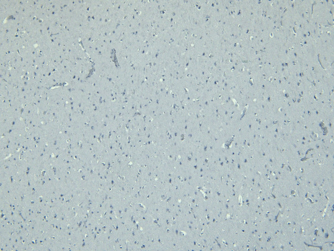 IBA1 Antibody in Immunohistochemistry (Paraffin) (IHC (P))