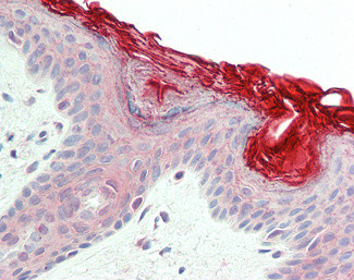 PERP Antibody in Immunohistochemistry (Paraffin) (IHC (P))