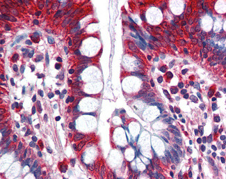 ACSL5 Antibody in Immunohistochemistry (Paraffin) (IHC (P))