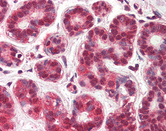 NR4A1 Antibody in Immunohistochemistry (Paraffin) (IHC (P))