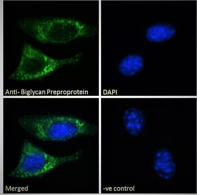 Biglycan Antibody in Immunocytochemistry (ICC/IF)