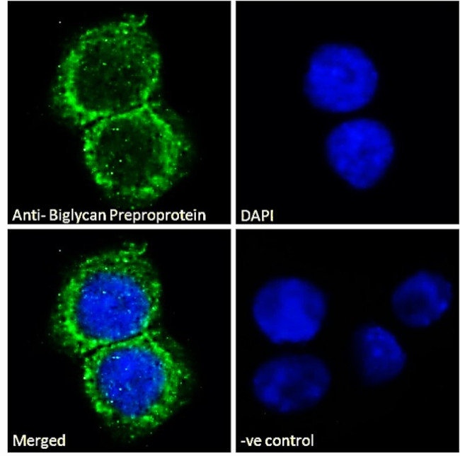 Biglycan Antibody in Immunocytochemistry (ICC/IF)