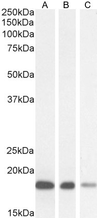 ARF1/ARF2/ARF3/ARF4 Antibody in Western Blot (WB)