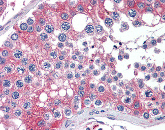 APOBEC3G Antibody in Immunohistochemistry (Paraffin) (IHC (P))