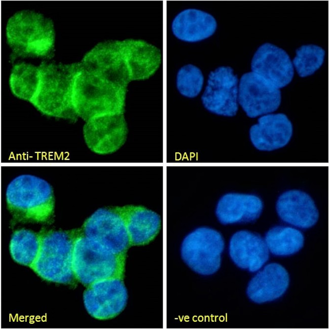 TREM2 Antibody in Immunocytochemistry (ICC/IF)