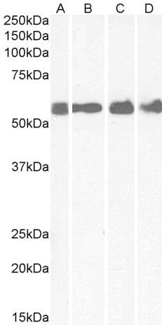 CRHR1 Antibody in Western Blot (WB)