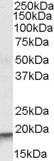 ARPC4 Antibody in Western Blot (WB)