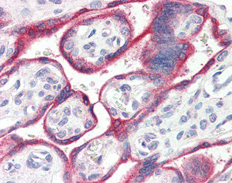 Aromatase Antibody in Immunohistochemistry (Paraffin) (IHC (P))