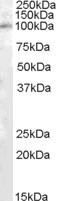 PAM Antibody in Western Blot (WB)