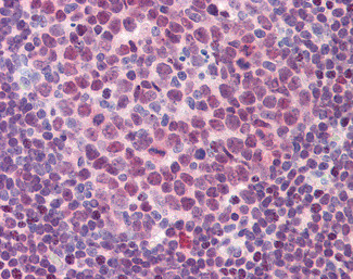 PU.1 Antibody in Immunohistochemistry (Paraffin) (IHC (P))