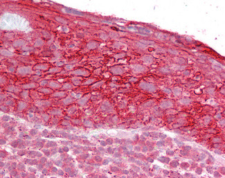 TROP2 Antibody in Immunohistochemistry (Paraffin) (IHC (P))