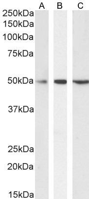 SEPT6 Antibody in Western Blot (WB)