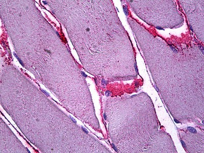 SFRP4 Antibody in Immunohistochemistry (Paraffin) (IHC (P))