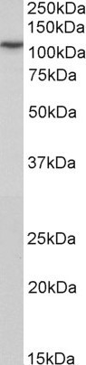 PSD-95 Antibody in Western Blot (WB)