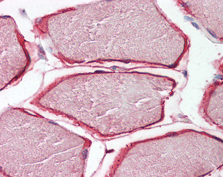 Caveolin 3 Antibody in Immunohistochemistry (Paraffin) (IHC (P))