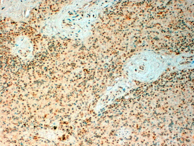 TET2 Antibody in Immunohistochemistry (Paraffin) (IHC (P))