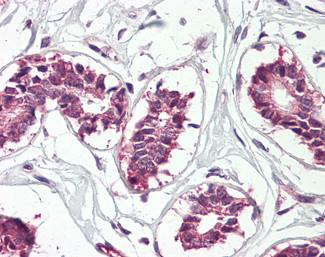 IGF2BP1 Antibody in Immunohistochemistry (Paraffin) (IHC (P))