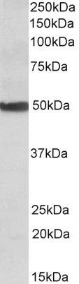 CYP24A1 Antibody in Western Blot (WB)