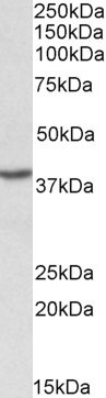 PCBP1 Antibody in Western Blot (WB)