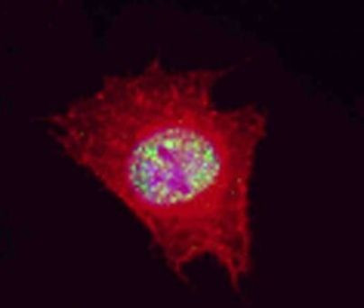 CDK9 Antibody in Immunocytochemistry (ICC/IF)