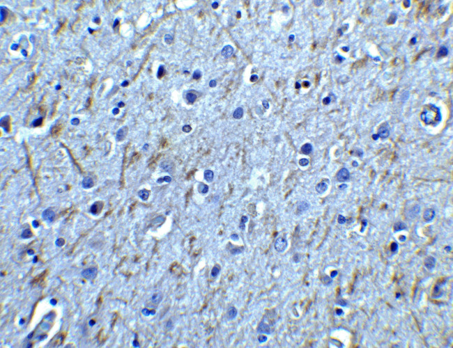 GFR alpha-1 Antibody in Immunohistochemistry (IHC)