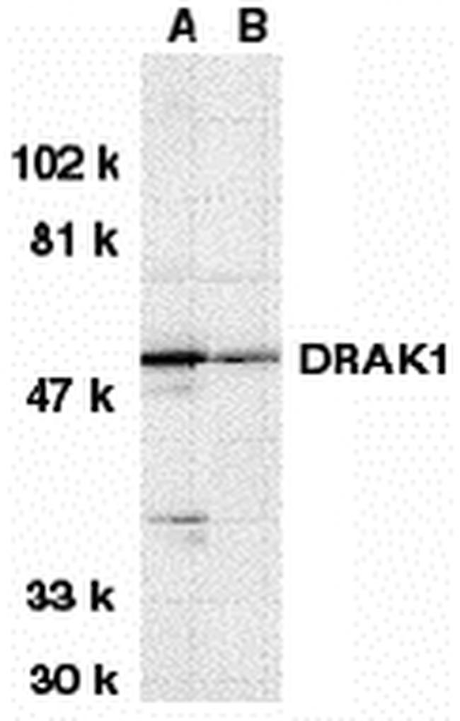 DRAK1 Antibody in Western Blot (WB)