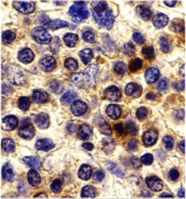 CX3CR1 Antibody in Immunohistochemistry (IHC)