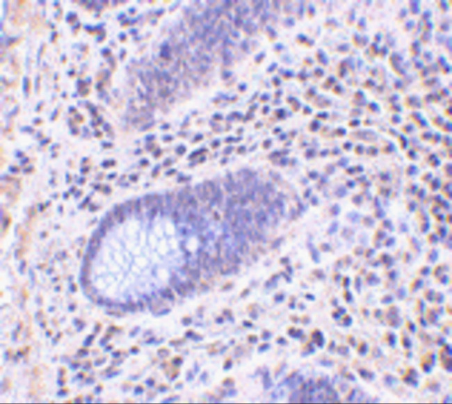 Lano Antibody in Immunohistochemistry (IHC)