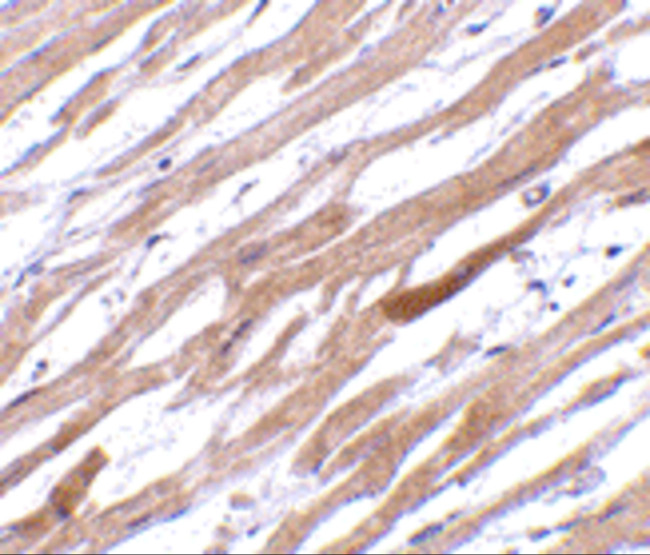 TIRAP Antibody in Immunohistochemistry (IHC)