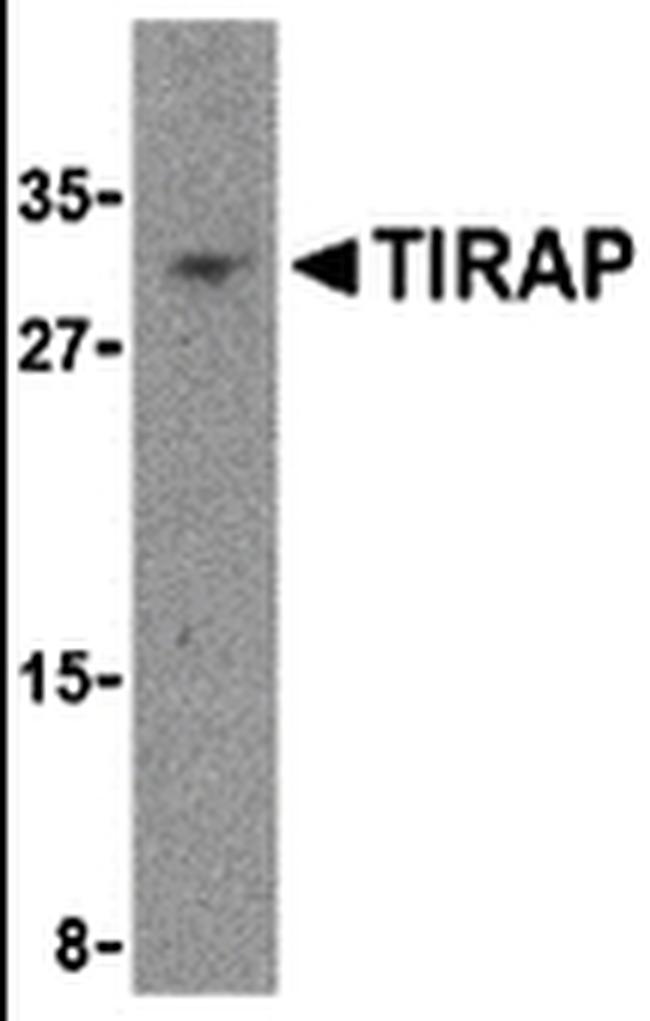 TIRAP Antibody in Western Blot (WB)