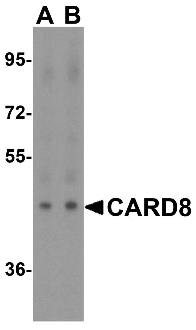 CARD8 Antibody in Western Blot (WB)