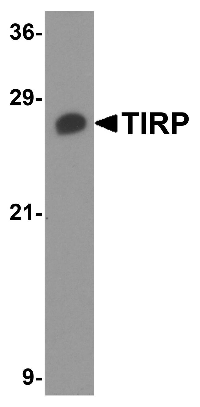 TICAM2 Antibody in Western Blot (WB)