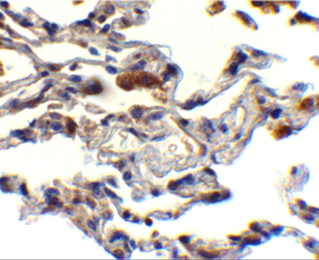 cIAP1 Antibody in Immunohistochemistry (Paraffin) (IHC (P))