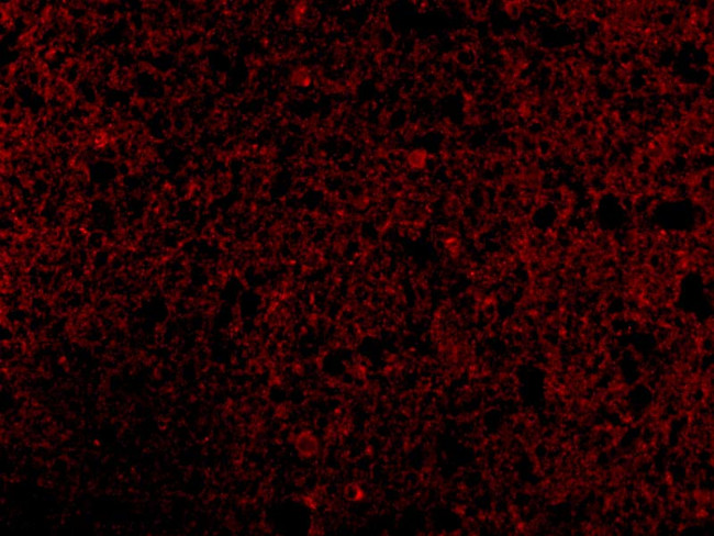 CRMP1 Antibody in Immunocytochemistry (ICC/IF)