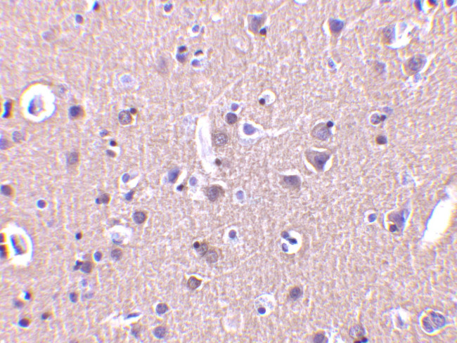 CRMP1 Antibody in Immunohistochemistry (IHC)