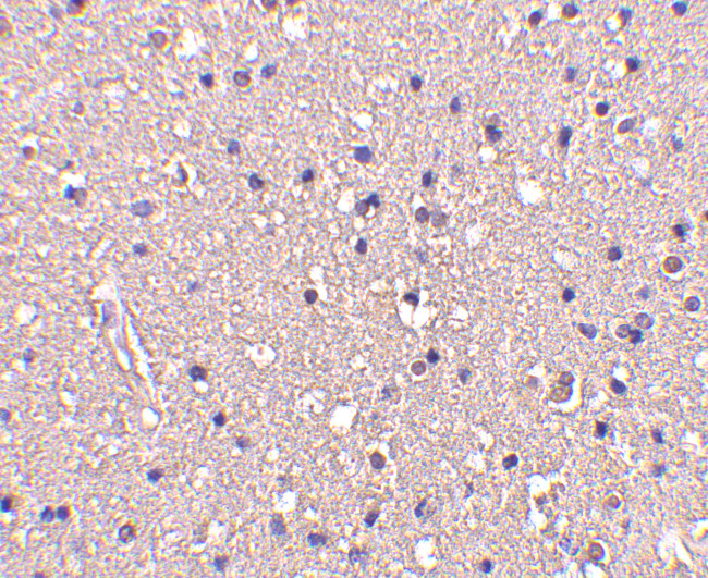 CRMP1 Antibody in Immunohistochemistry (IHC)